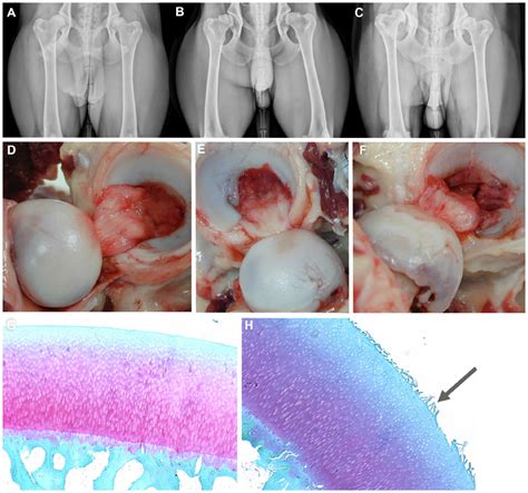 We did not find results for: Full text Diagnosis, prevention, and management of ...