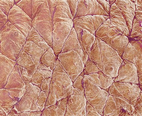 Human Skin Surface Sem Stock Image P7100359 Science Photo Library