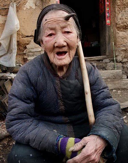 Troy Tashaz Blog Unbelieveable Chinese Woman Grows Horn On Head