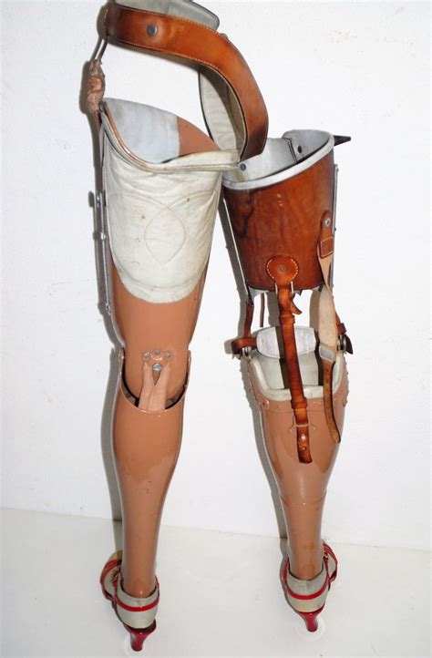 Vintage Rare Pair Of Womens Metal Prosthetic Leg Double Leg Amputee In