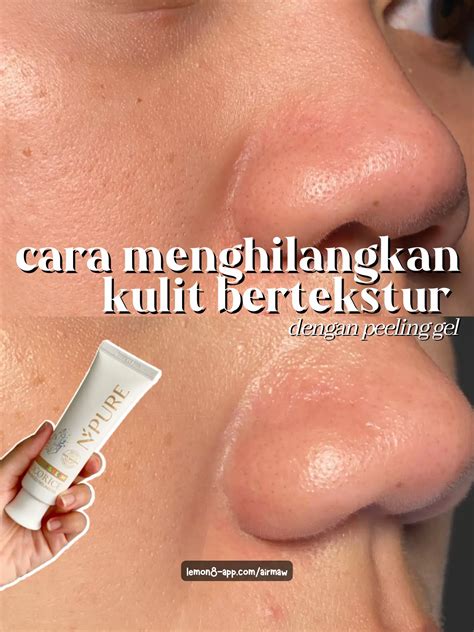 Cara mengurangi kulit bertekstur 🦔⚡️ | Galeri diposting oleh airmaw