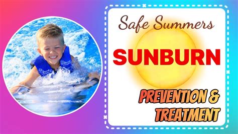 Sunburn Prevention And Care Youtube