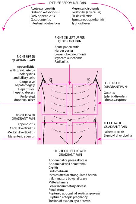 Causes Of Upper Abdominal Pain