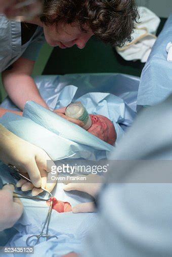 Newborn Being Circumcised Photo Getty Images