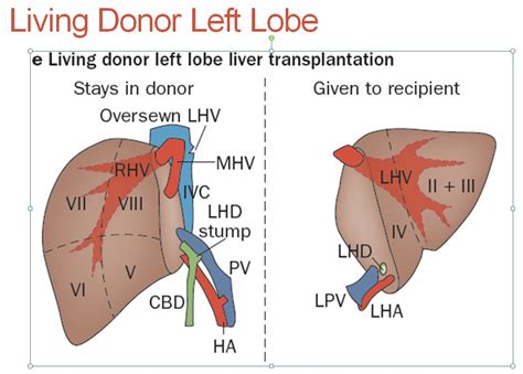 Liver Living Donor Uw Ultrasound