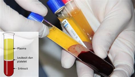 Komponen Darah Manusia Dan Fungsinya Kerajaan Biologi