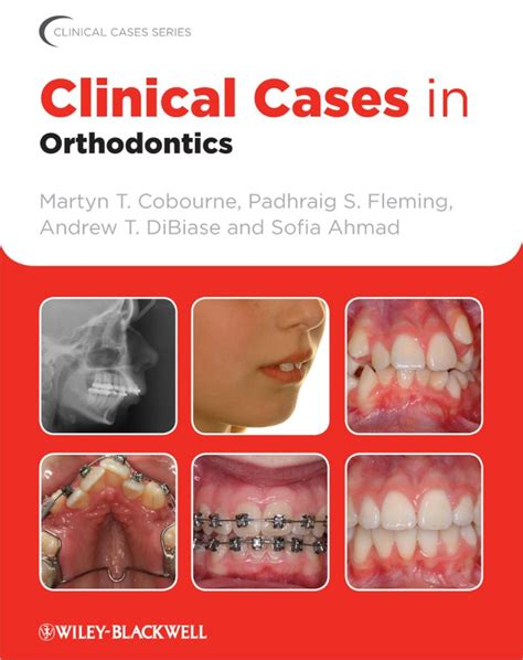 Clinical Cases In Orthodontics Ebook Orthodontics Dentistry