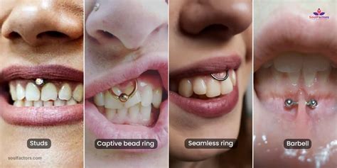 Gum Piercing Exploring The Unique Oral Body Modification Trend