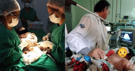 Macrosomía Fetal El Sorprendente Caso De Un Bebé Gigante Que Nació En