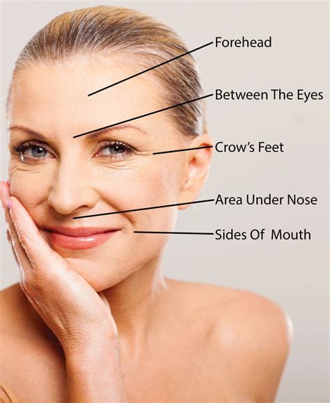 Botox Pricing Guide How Much Does Botox Cost Top Areas 41 Off