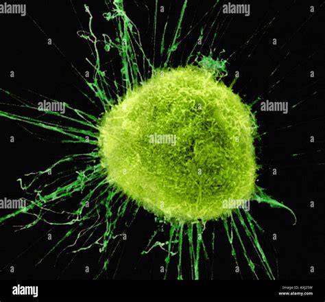 Human Cancer Cell Stock Photo Alamy