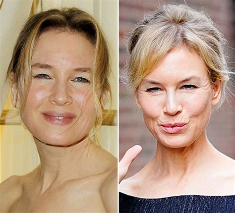 Ren E Zellweger Turns How Plastic Surgery Changed Her Look Over The Years Demotix