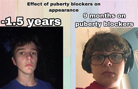 effect of puberty blockers on facial hair and appearance r transtimelines