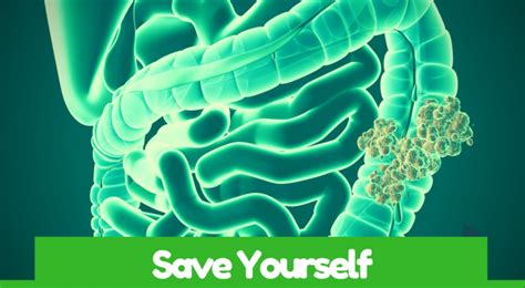 10 Warning Signs Of Colon Cancer You Should Not Ignore Huffington News