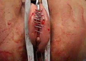 Needle Pain BDSM Extreme Tit Torture Pussy Torture TG Page 8