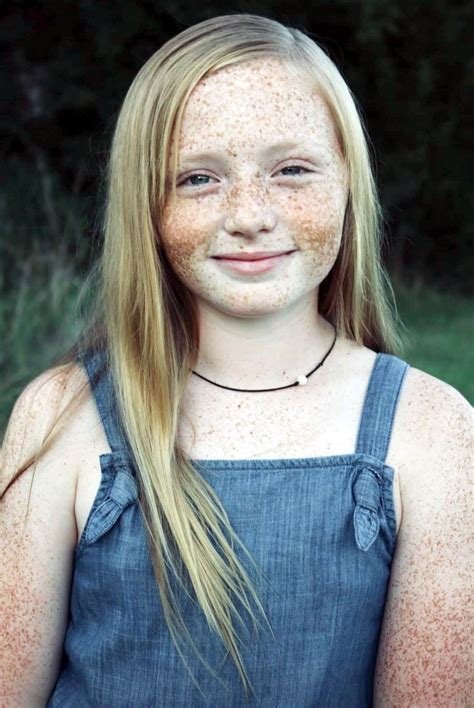 Taches De Rousseur In Beautiful Freckles Red Hair Freckles