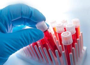 What Is An Anion Gap Blood Test Science