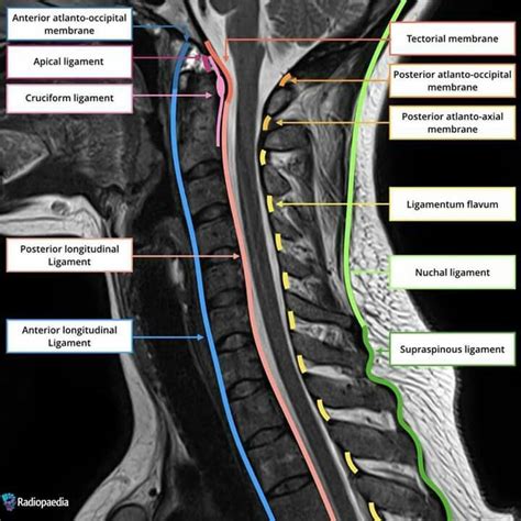 Ligaments Of Vertebral Column Radiography Anatomy Anatomy