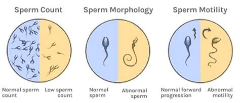 Sperm And Semen Testing And Evaluation Centers Leading Edge