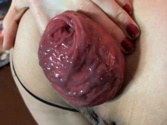 Cervix Prolapse Xxx Big Ass Wife Very Closeup POV Anal Prolapse Porn