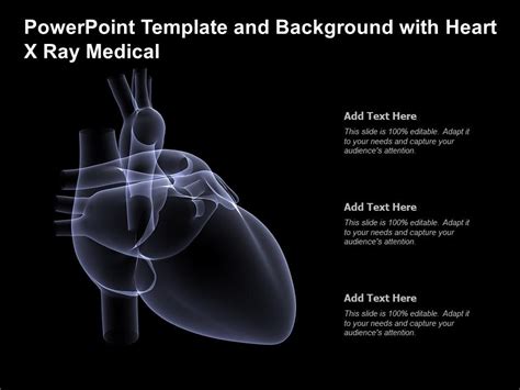 X Ray Powerpoint Templates