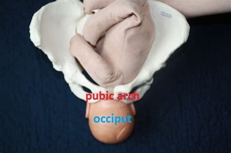 Learn the different methods for pushing during the second stage of labor and why you might choose one method over another. Natural Birth In Kitsap: Optimal Fetal Positioning, Part 3 ...