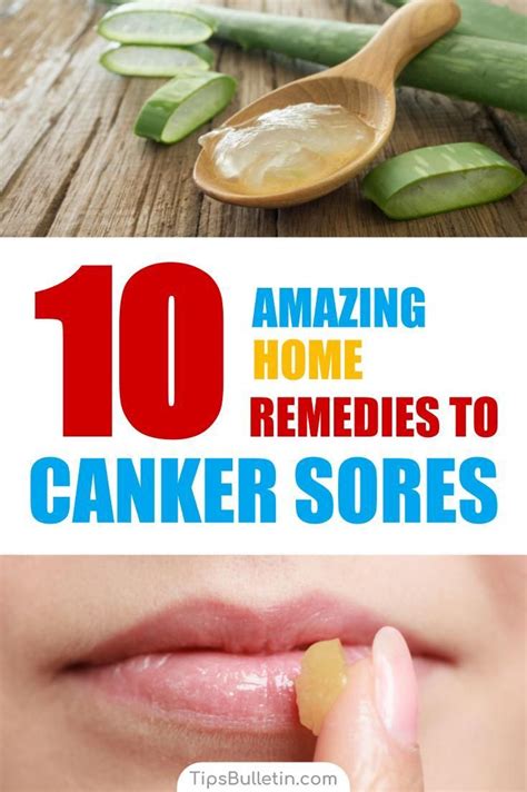 canker sore on tongue canker sore relief canker sore causes canker sore treatment canker