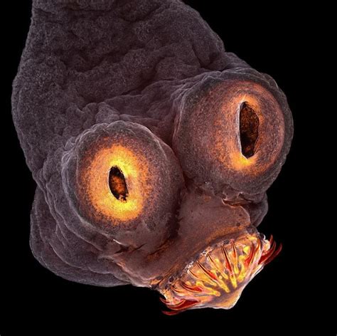 Real Photo Intestinal Parasite By Teresa Zgoda Microscopic