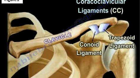 There are many different causes or conditions that result in pain or discomfort in your collarbone. Clavicle Fractures | HuffPost