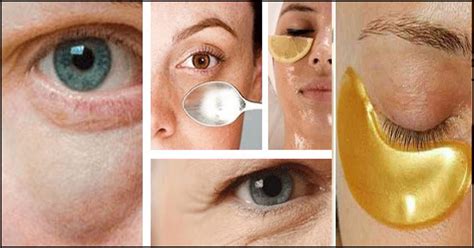 17 Easy Home Remedies To Get Rid Of Under Eye Bags Sports Health