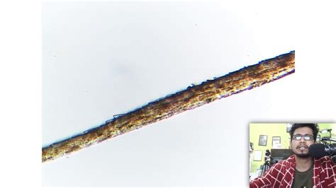 Human Hair Under Microscope 400x Slidesharetrick