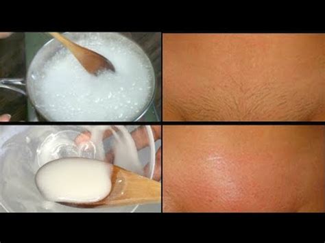 See the product's profile for more information. BAKING SODA REMOVE PUIBIC HAIR, 4 DAYS TO COMPLETELY ...