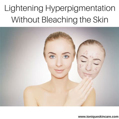 Lightening Hyperpigmentation Without Bleaching The Skin Tonique Skincare