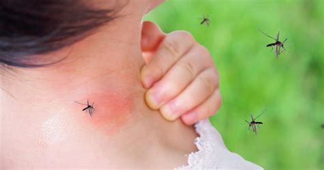 Mosquito Bites Childrens Primary Care Medical Group