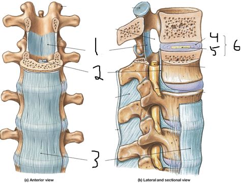 Ligamentum flavum hypertrophy is also commonly known as ligamentum flavum thickening. Chapter 8: Joints at Saint Louis University - StudyBlue