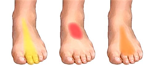 What Causes Of Foot Pain Symptoms