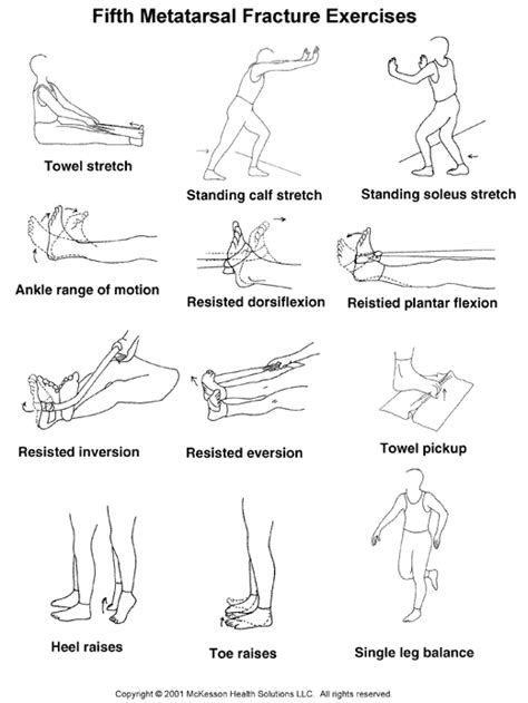 Sports Medicine Advisor 20031 Fifth Metatarsal Fracture Exercises