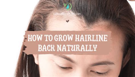 Best Tips To Pocket How To Grow Hairline Back Naturally Skincare Top