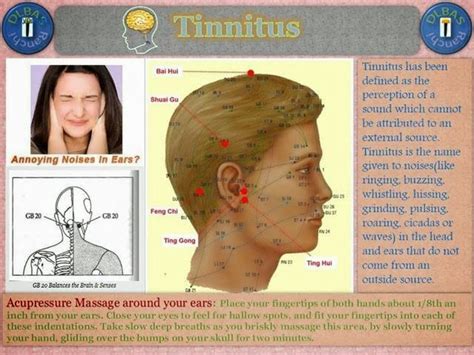 Acupressure And Natural Therapy Tinnitus
