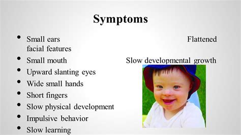 Downs Syndrome Facial Characteristics