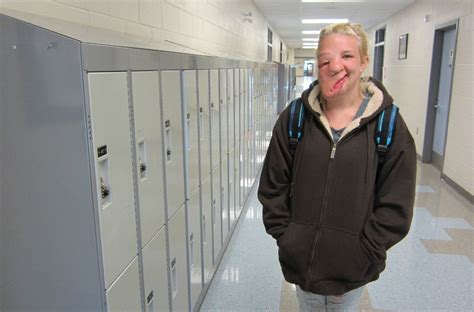 the girl with half a face teen with rare facial deformity opens up in new documentary fox news