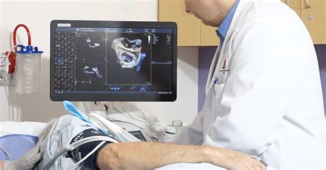 Mais apres, ca se passe comment? Échographie cardiaque transoesophagienne