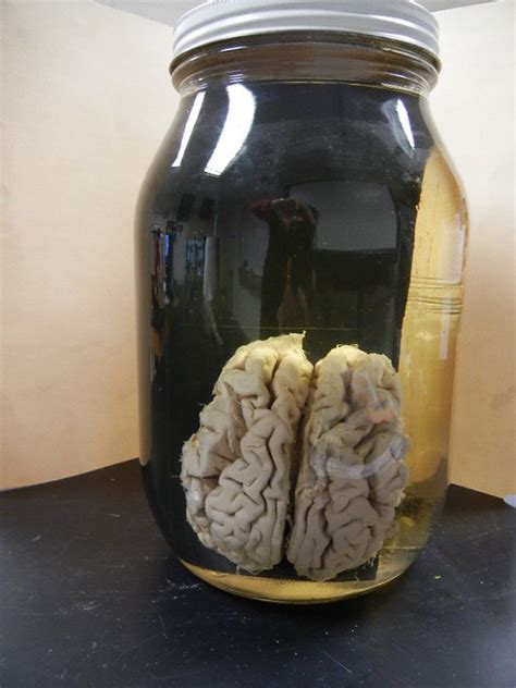 Human Brain In A Jar Flickr Photo Sharing