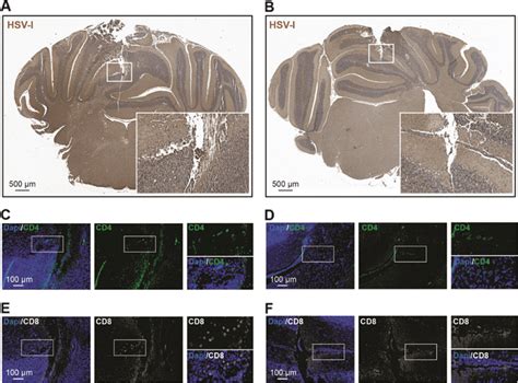 It is typically the cause of cold sores around the mouth. Cerebellar analysis for HSV-1 in mice inoculated with 1 ...