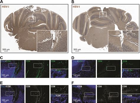 Sep 08, 2020 · genotype herpes simplex virus (hsv) types 1 and 2. Cerebellar analysis for HSV-1 in mice inoculated with 1 × 10⁷... | Download Scientific Diagram