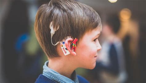 Personalise Your Hearing Aid Personalising Cochlear Implants