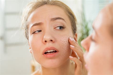 How To Combat Dry Winter Skin Face Doctor