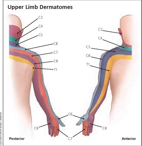 Figure 2 From Peripheral Nerve Entrapment And Injury In The Upper