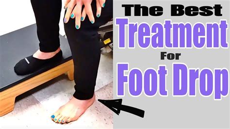Foot Drop Exercises To Improve Walking Part 1 Foot Drop Exercises