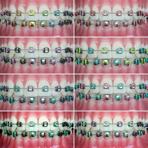 Choose from hundreds of color schemes here. Looking to add some color to your braces? Try one of these ...